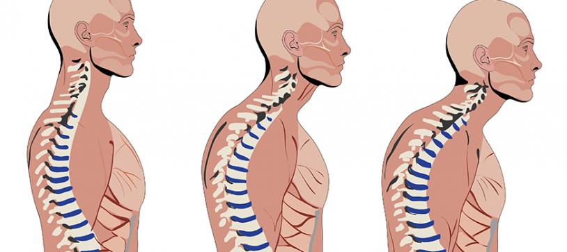 Posture – More Than Just Standing Straight